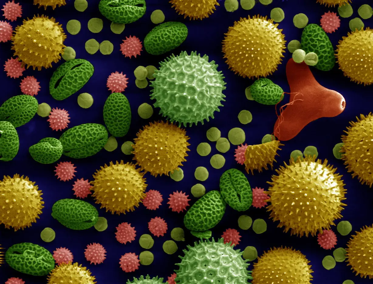 Photograph: pollen grains under an electron microscope, colourised